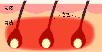 LUMIX SHR脱毛